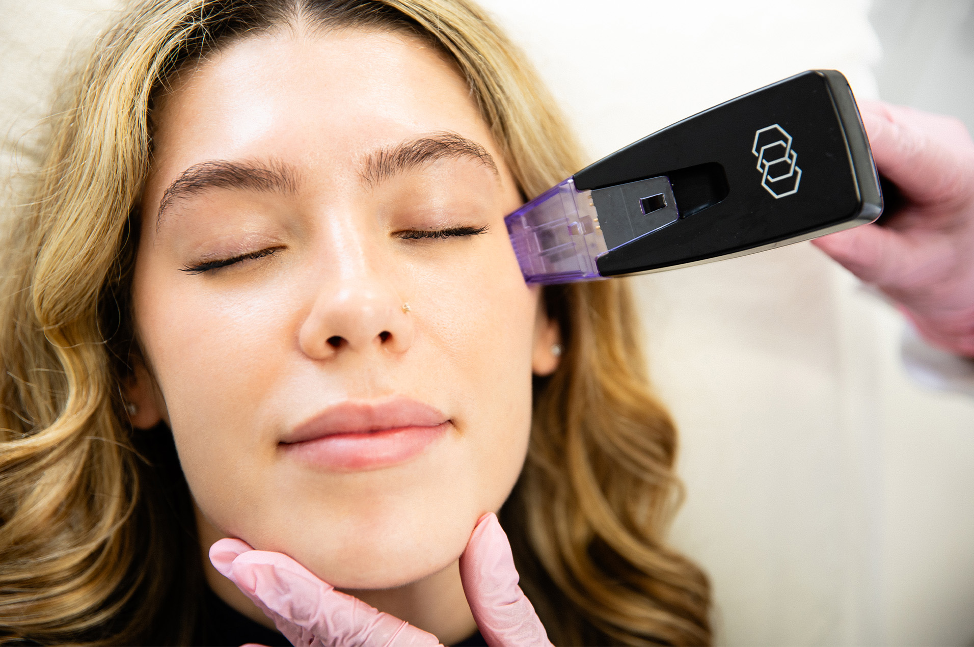 Woman receiving Morpheus8 treatment